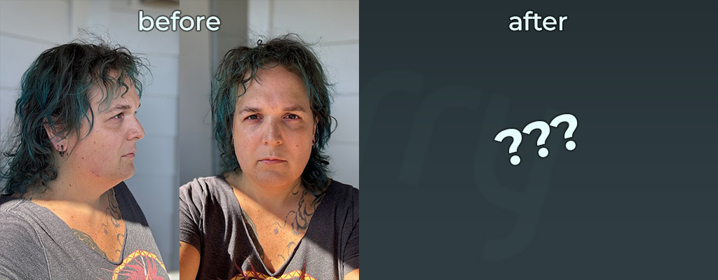 Before and after photo for facial feminization surgery, except the after photo is question marks
