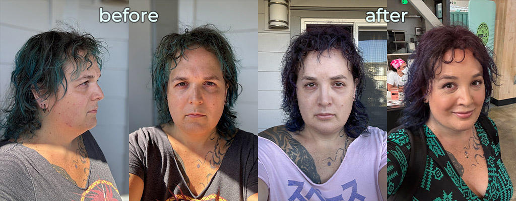 Corry Before and After FFS with and without makeup
